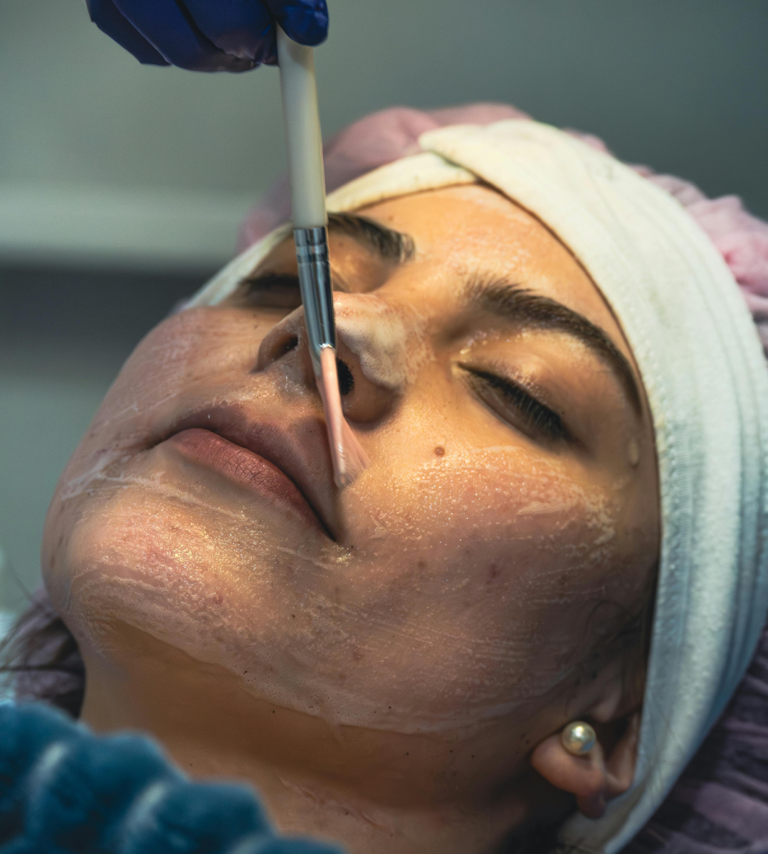 VI Peel chemical peel treatment at IUVENTUS Medical Center Las Vegas