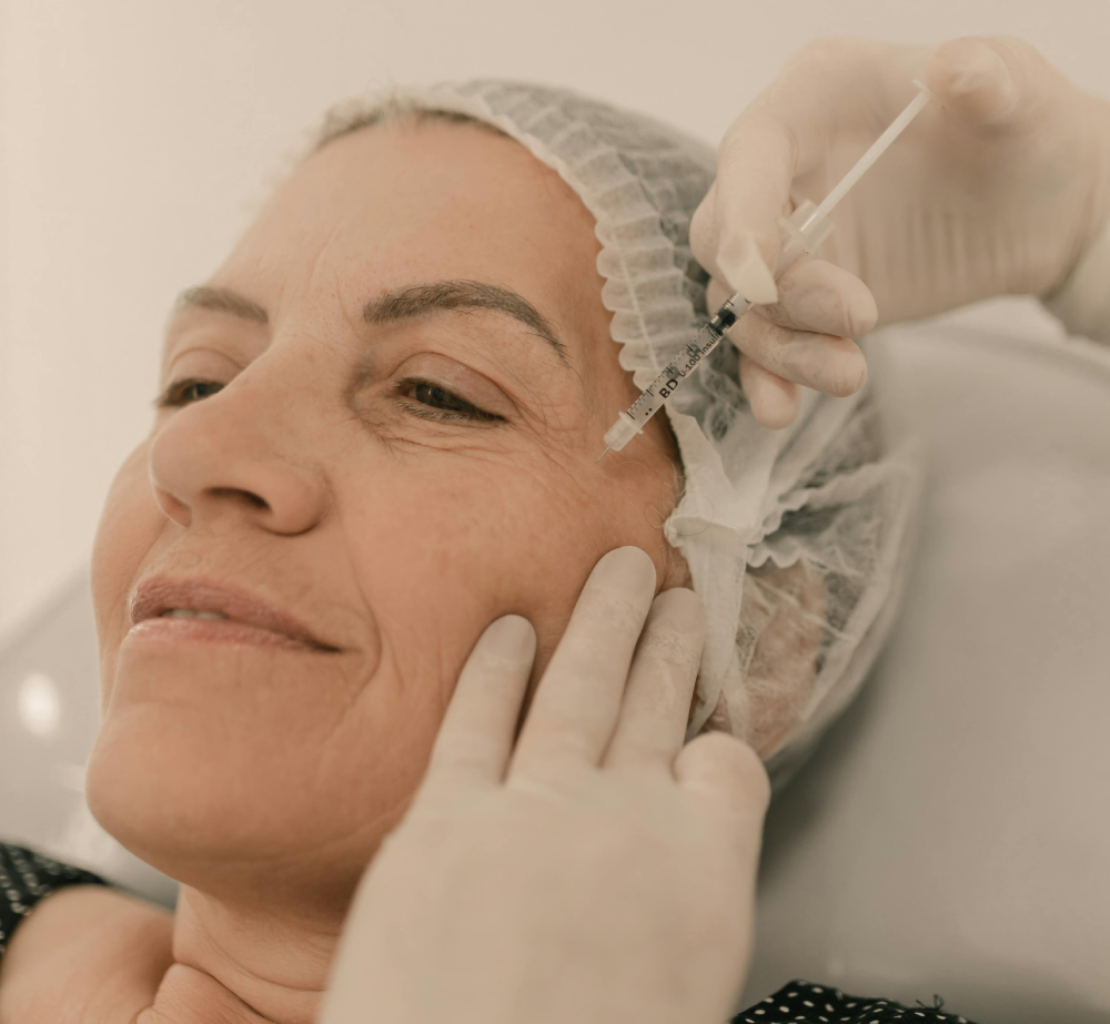 PRP Facial