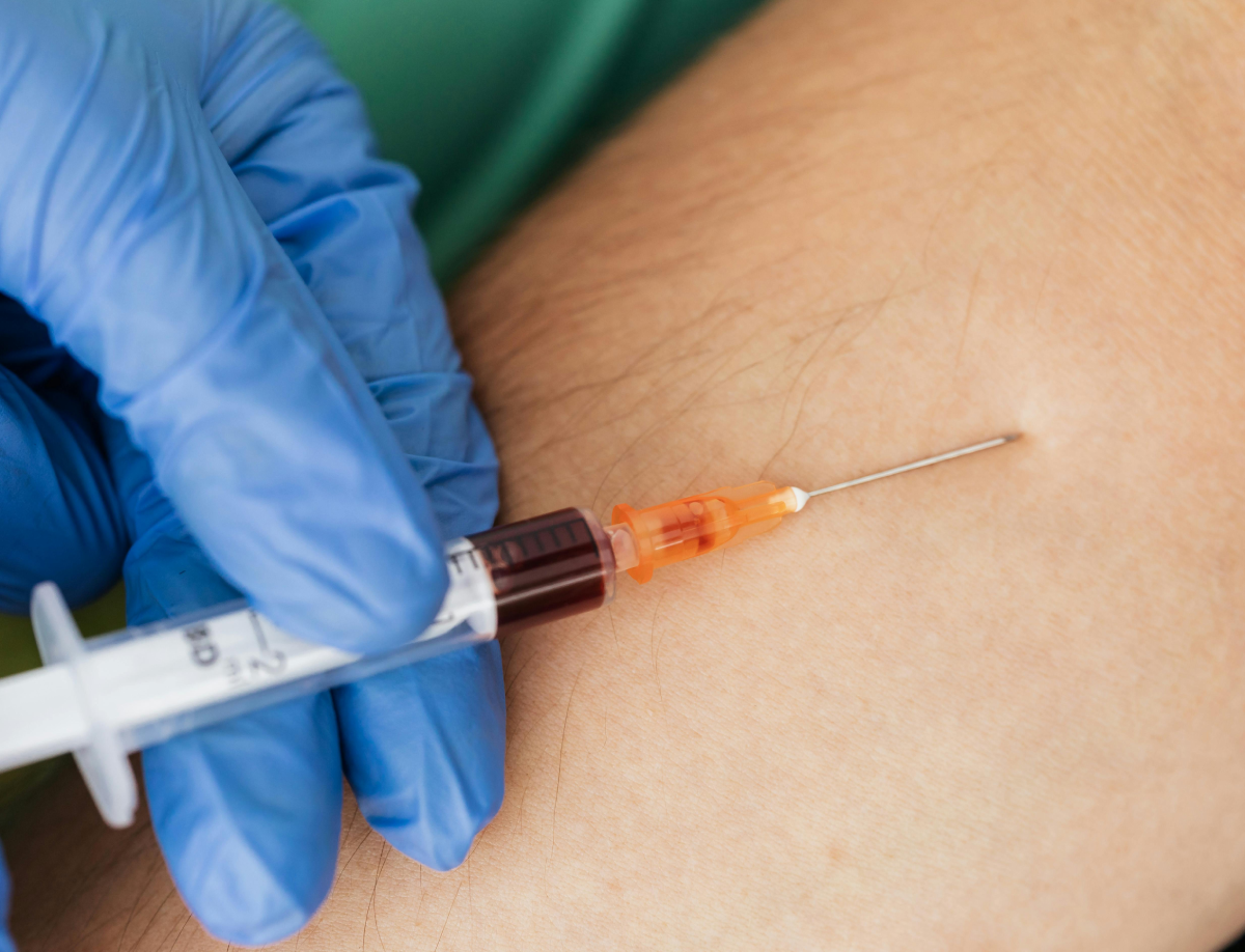PRP for Injury
