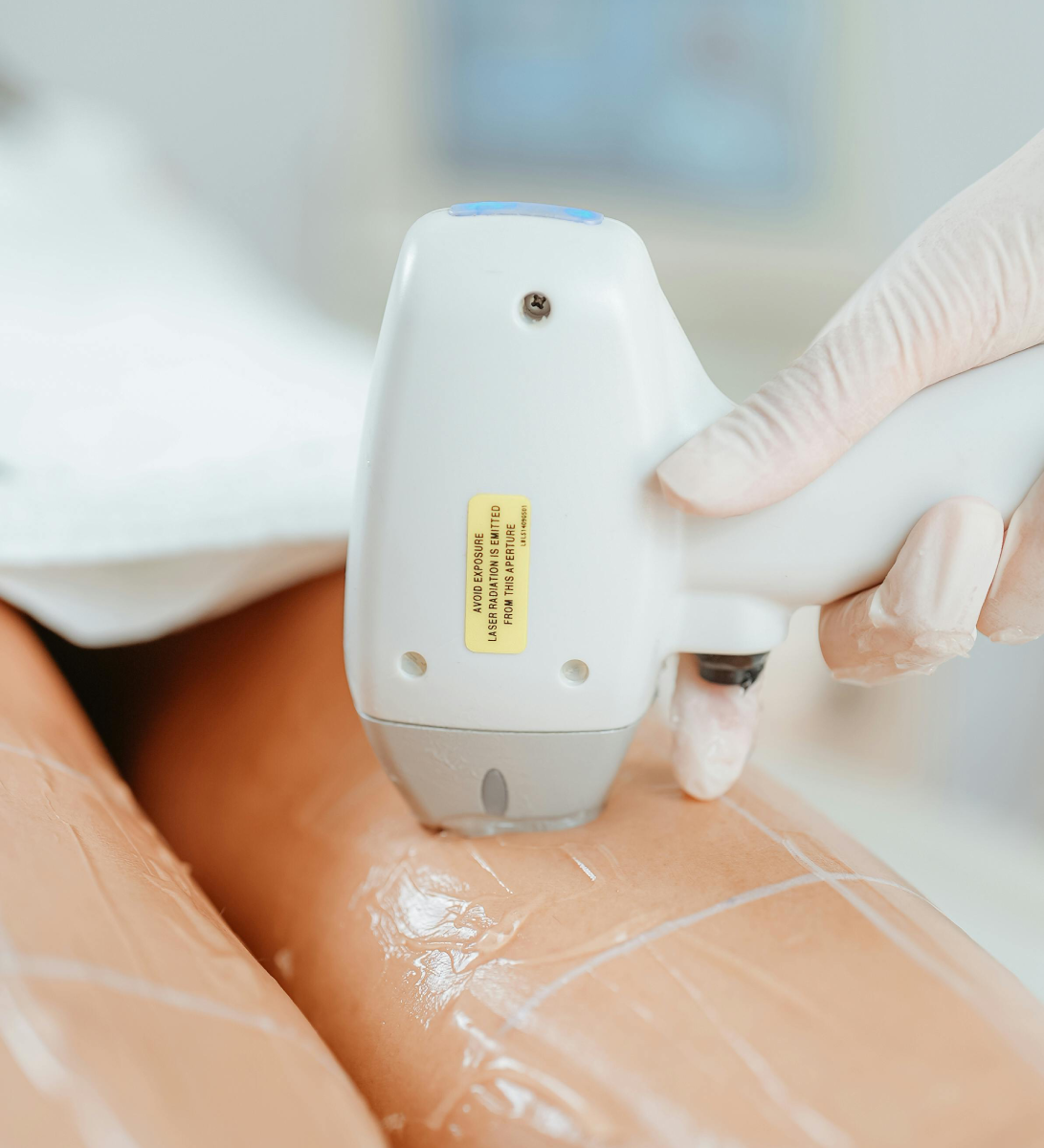 Shockwave cellulite reduction at IUVENTUS Medical Center Las Vegas